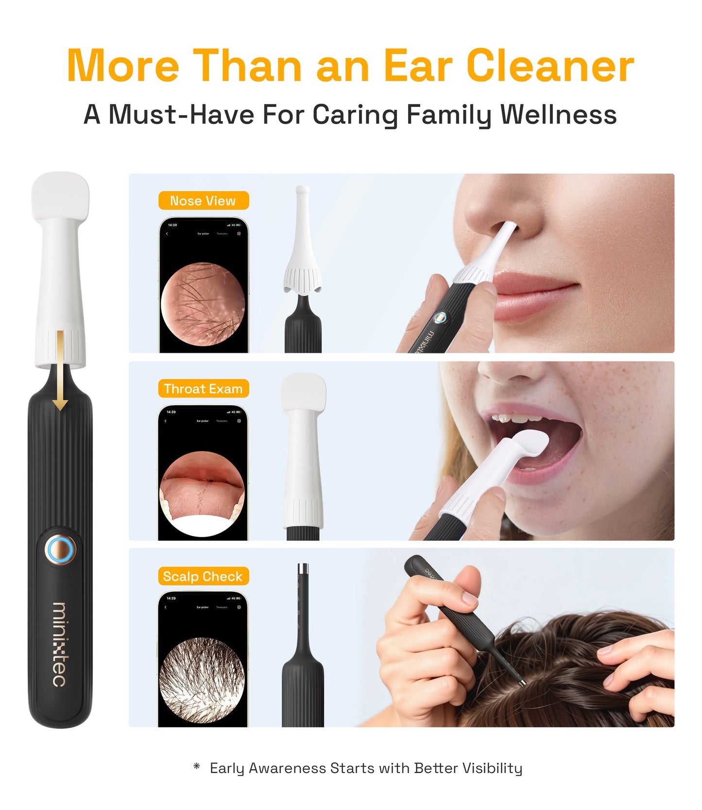 Wireless Otoscope Earwax Removal Kit With HD Camera