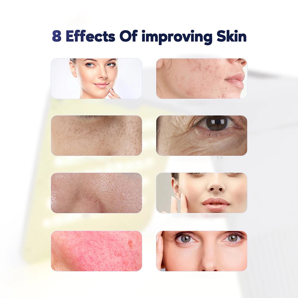 Foreverlily LED Light Therapy Beauty Machine For Home Skin Rejuvenation