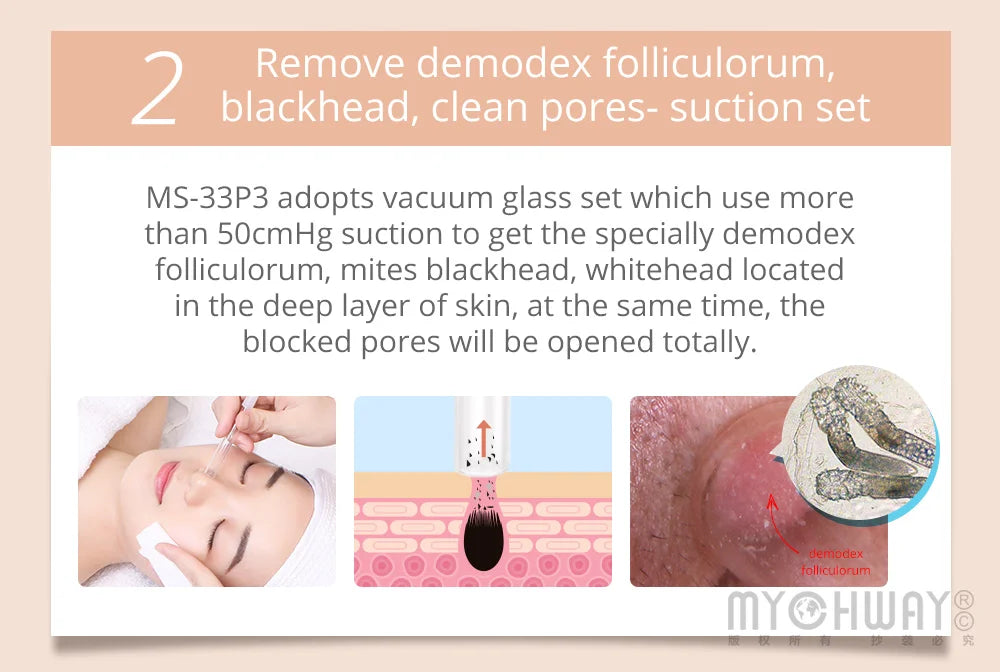 Mychway Ultrasound Facial Dermabrasion Beauty Device For Skin Care